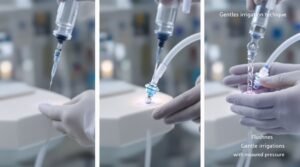 prevent tube feeding occlusion